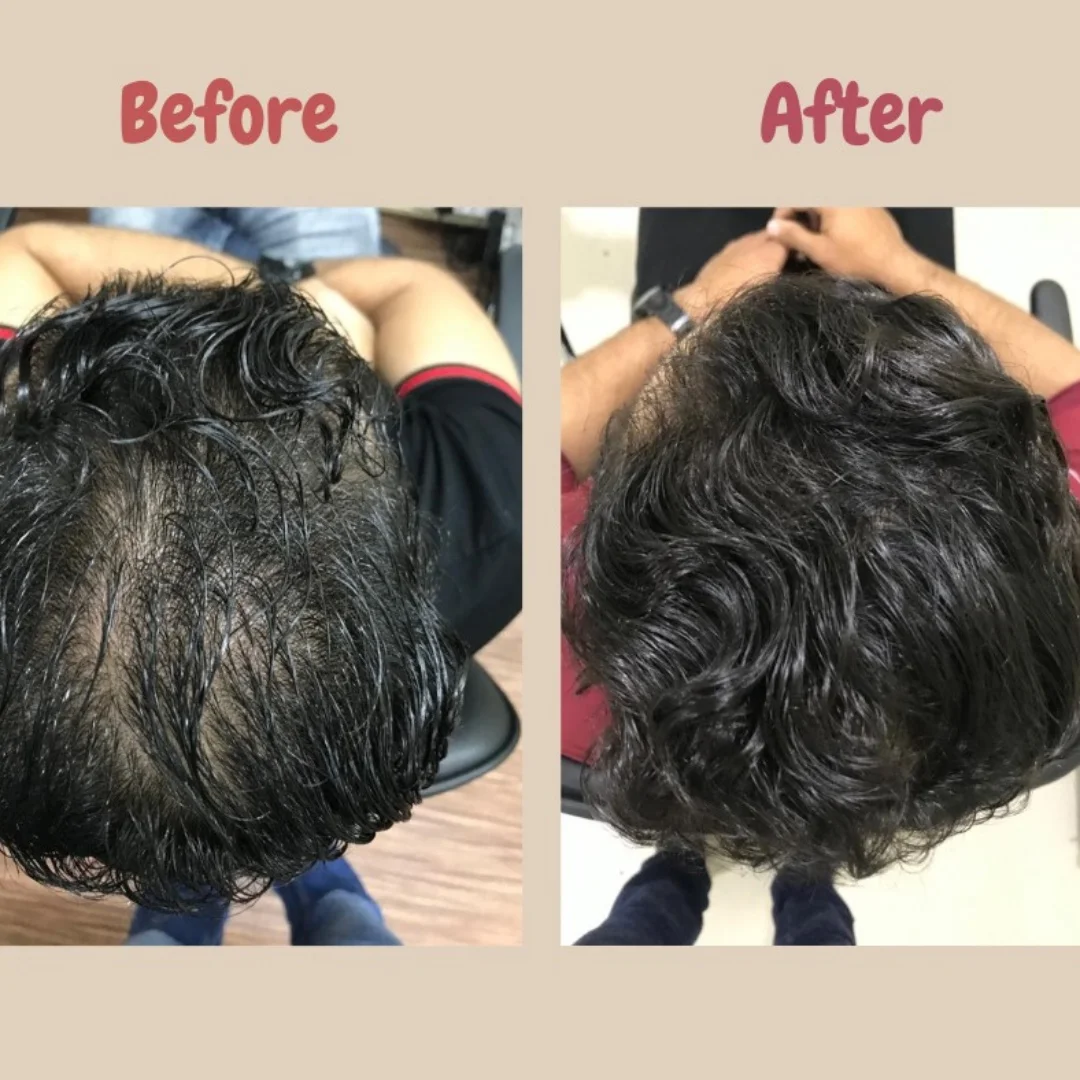 Hair scan right view